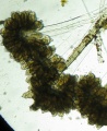 Opercularia ampluscolonia1.jpg